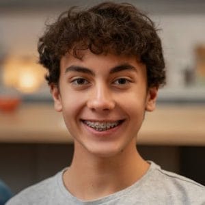 Damon Braces: Self-Ligating System for Faster Results